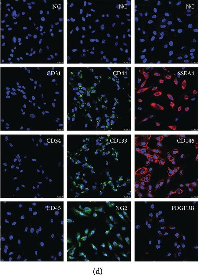 Rabbit IgG (H+L) Highly Cross-Adsorbed Secondary Antibody in Immunocytochemistry (ICC/IF)