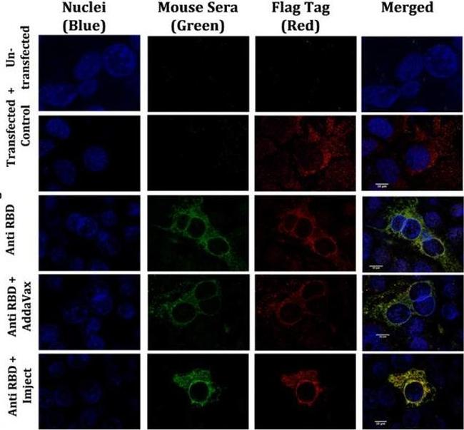 Mouse IgG (H+L) Highly Cross-Adsorbed Secondary Antibody in Immunocytochemistry (ICC/IF)