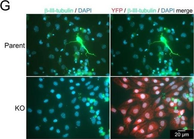 Rabbit IgG (H+L) Cross-Adsorbed Secondary Antibody in Immunocytochemistry (ICC/IF)