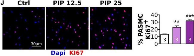 Rabbit IgG (H+L) Cross-Adsorbed Secondary Antibody in Immunohistochemistry (Paraffin) (IHC (P))