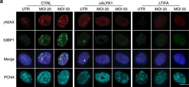 Rabbit IgG (H+L) Highly Cross-Adsorbed Secondary Antibody in Immunocytochemistry (ICC/IF)