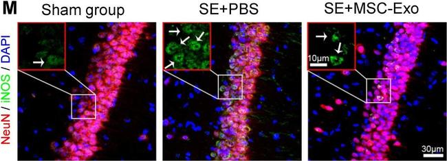 Rabbit IgG (H+L) Highly Cross-Adsorbed Secondary Antibody in Immunohistochemistry (IHC)