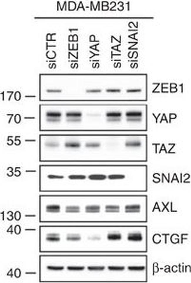 Mouse IgG (H+L) Secondary Antibody in Western Blot (WB)