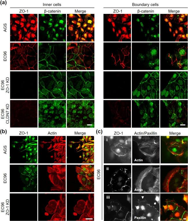 Rabbit IgG (H+L) Cross-Adsorbed Secondary Antibody in Immunocytochemistry (ICC/IF)