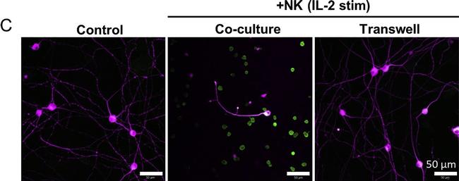 Rabbit IgG (H+L) Highly Cross-Adsorbed Secondary Antibody in Immunocytochemistry (ICC/IF)