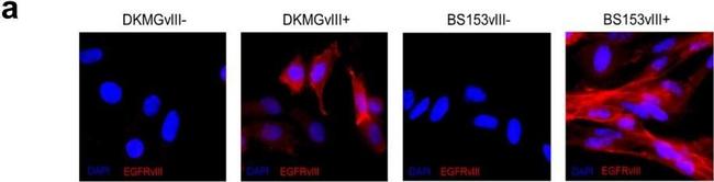 Mouse IgG (H+L) Cross-Adsorbed Secondary Antibody in Immunocytochemistry (ICC/IF)