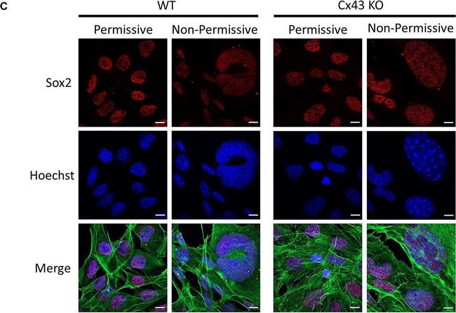 Mouse IgG (H+L) Cross-Adsorbed Secondary Antibody in Immunocytochemistry (ICC/IF)