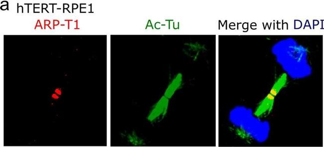 Mouse IgG (H+L) Cross-Adsorbed Secondary Antibody in Immunocytochemistry (ICC/IF)