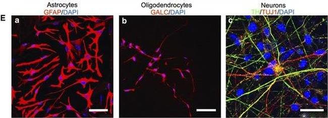 Mouse IgG (H+L) Cross-Adsorbed Secondary Antibody in Immunocytochemistry (ICC/IF)