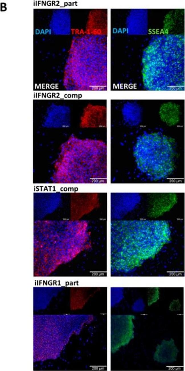 Mouse IgG (H+L) Highly Cross-Adsorbed Secondary Antibody in Immunocytochemistry (ICC/IF)