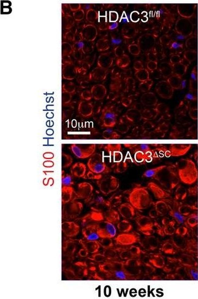 Rabbit IgG (H+L) Cross-Adsorbed Secondary Antibody in Immunocytochemistry (ICC/IF)