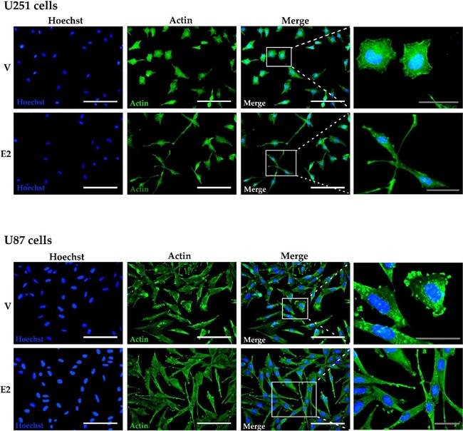 Mouse IgG (H+L) Cross-Adsorbed Secondary Antibody in Immunocytochemistry (ICC/IF)