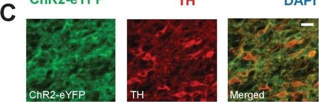 Rabbit IgG (H+L) Cross-Adsorbed Secondary Antibody in Immunohistochemistry (IHC)