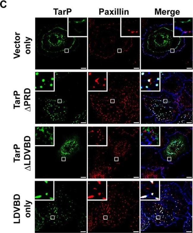 Rabbit IgG (H+L) Highly Cross-Adsorbed Secondary Antibody in Immunocytochemistry (ICC/IF)