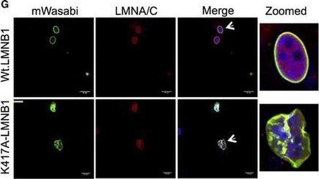 Rabbit IgG (H+L) Cross-Adsorbed Secondary Antibody in Immunocytochemistry (ICC/IF)