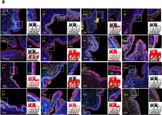 Rabbit IgG (H+L) Highly Cross-Adsorbed Secondary Antibody in Immunohistochemistry (Paraffin) (IHC (P))