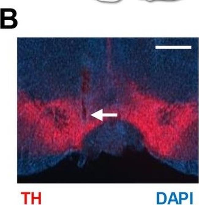 Rabbit IgG (H+L) Cross-Adsorbed Secondary Antibody in Immunohistochemistry (IHC)