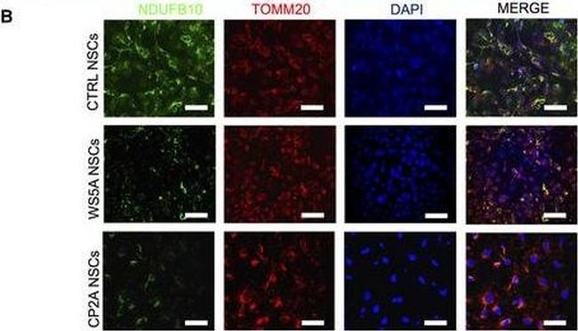 Mouse IgG (H+L) Cross-Adsorbed Secondary Antibody in Immunocytochemistry (ICC/IF)