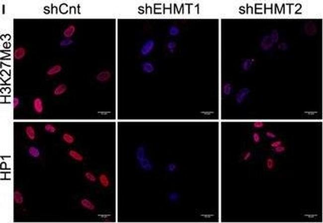 Rabbit IgG (H+L) Cross-Adsorbed Secondary Antibody in Immunocytochemistry (ICC/IF)