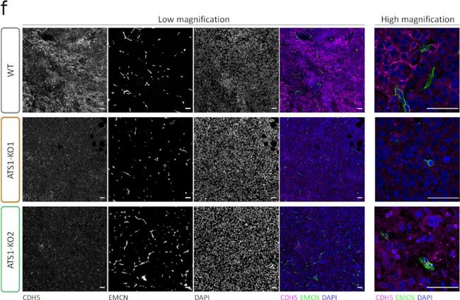 Rabbit IgG (H+L) Highly Cross-Adsorbed Secondary Antibody in Immunohistochemistry (IHC)