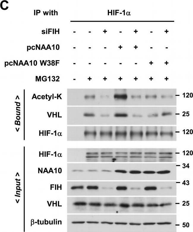 Rabbit IgG (H+L) Cross-Adsorbed Secondary Antibody in Western Blot (WB)