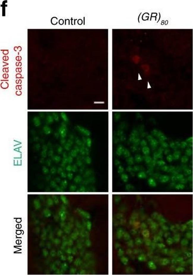 Rabbit IgG (H+L) Highly Cross-Adsorbed Secondary Antibody in Immunocytochemistry (ICC/IF)