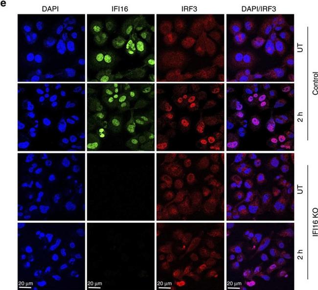 Mouse IgG (H+L) Cross-Adsorbed Secondary Antibody in Immunocytochemistry (ICC/IF)