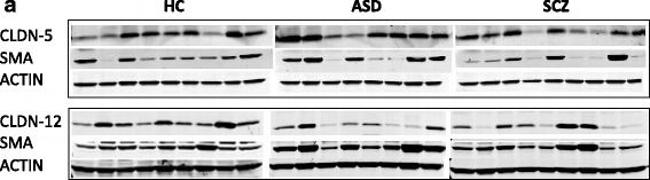 Mouse IgG (H+L) Cross-Adsorbed Secondary Antibody in Western Blot (WB)