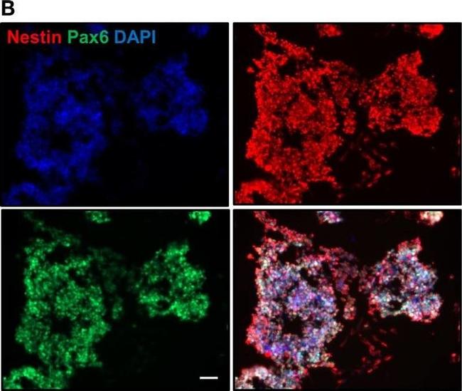 Mouse IgG (H+L) Cross-Adsorbed Secondary Antibody in Immunocytochemistry (ICC/IF)