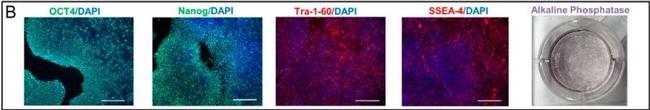 Mouse IgG (H+L) Highly Cross-Adsorbed Secondary Antibody in Immunocytochemistry (ICC/IF)