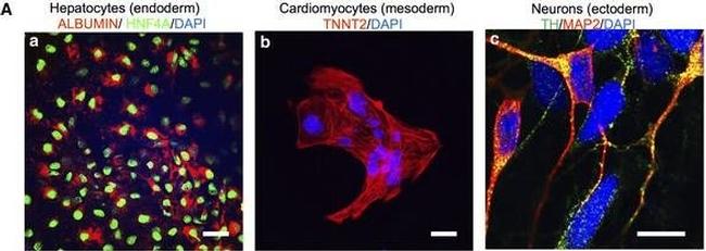 Mouse IgG (H+L) Cross-Adsorbed Secondary Antibody in Immunocytochemistry (ICC/IF)