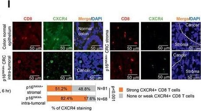 Rabbit IgG (H+L) Highly Cross-Adsorbed Secondary Antibody in Immunocytochemistry (ICC/IF)