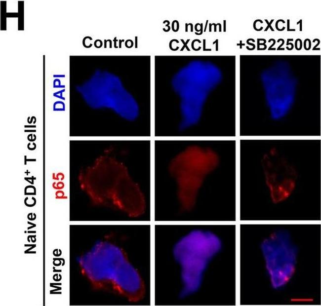 Mouse IgG (H+L) Cross-Adsorbed Secondary Antibody in Immunohistochemistry (IHC)