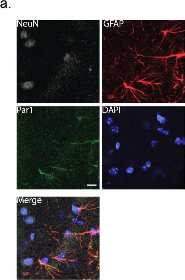 Rabbit IgG (H+L) Highly Cross-Adsorbed Secondary Antibody in Immunohistochemistry (IHC)