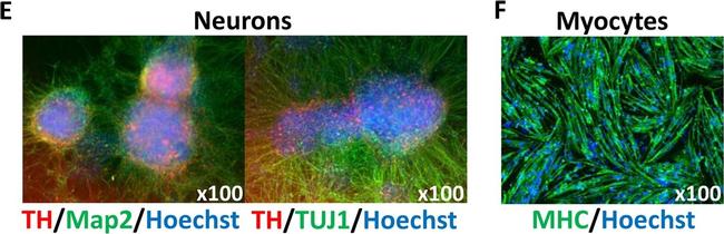 Rabbit IgG (H+L) Cross-Adsorbed Secondary Antibody in Immunocytochemistry (ICC/IF)