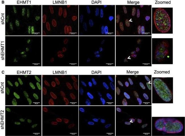 Rabbit IgG (H+L) Cross-Adsorbed Secondary Antibody in Immunocytochemistry (ICC/IF)