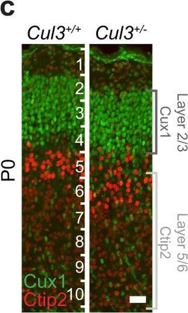 Mouse IgG (H+L) Cross-Adsorbed Secondary Antibody in Immunocytochemistry (ICC/IF)