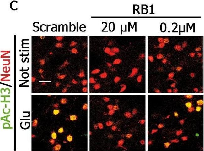 Mouse IgG (H+L) Cross-Adsorbed Secondary Antibody in Immunohistochemistry (IHC)