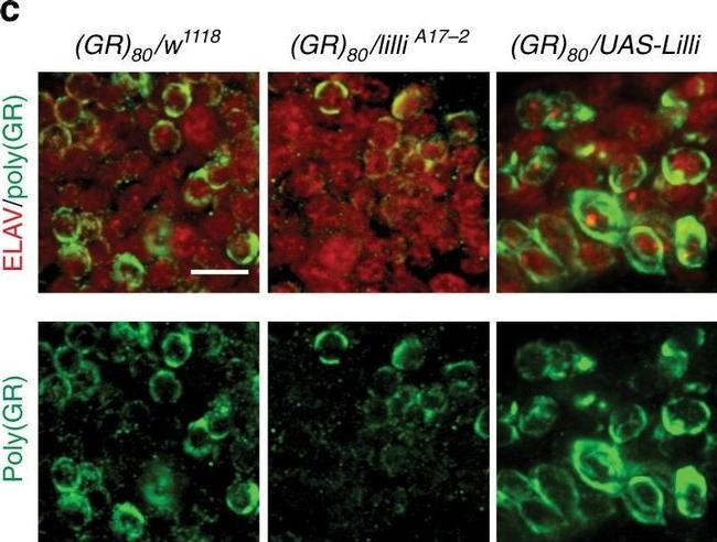 Rabbit IgG (H+L) Highly Cross-Adsorbed Secondary Antibody in Immunohistochemistry (IHC)