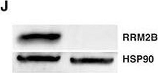 Mouse IgG (H+L) Secondary Antibody in Western Blot (WB)