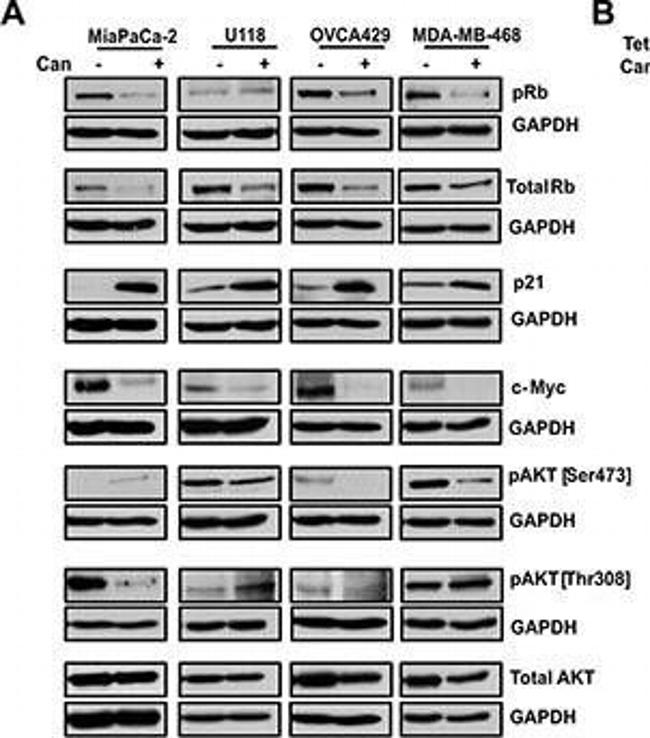 Rabbit IgG (H+L) Secondary Antibody in Western Blot (WB)