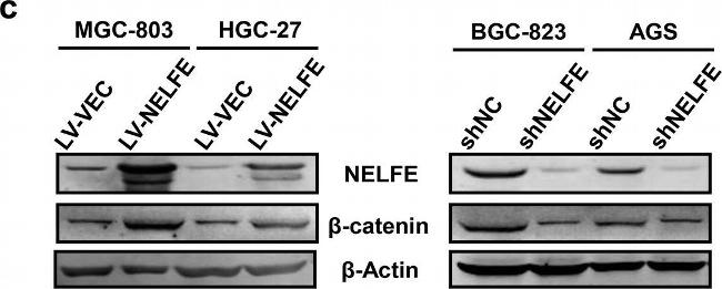 Rabbit IgG (H+L) Secondary Antibody in Western Blot (WB)