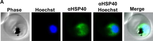 Rabbit IgG (H+L) Cross-Adsorbed Secondary Antibody in Immunocytochemistry (ICC/IF)