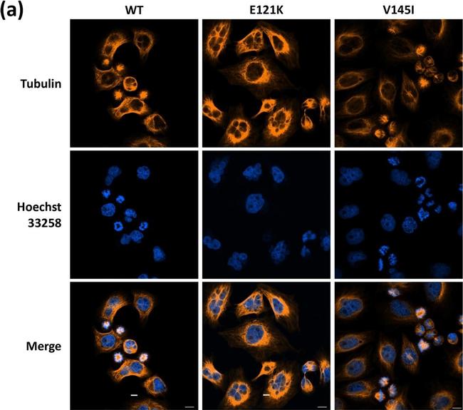 Mouse IgG (H+L) Highly Cross-Adsorbed Secondary Antibody in Immunocytochemistry (ICC/IF)