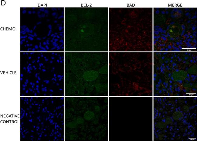 Rabbit IgG (H+L) Cross-Adsorbed Secondary Antibody in Immunohistochemistry (Paraffin) (IHC (P))