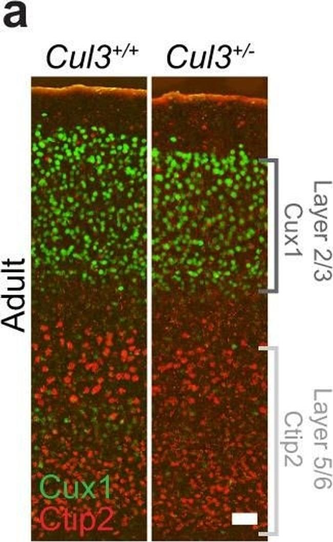 Mouse IgG (H+L) Cross-Adsorbed Secondary Antibody in Immunocytochemistry (ICC/IF)