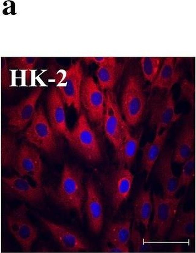 Rabbit IgG (H+L) Highly Cross-Adsorbed Secondary Antibody in Immunocytochemistry (ICC/IF)