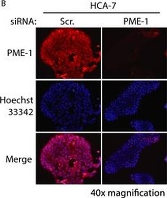 Mouse IgG (H+L) Cross-Adsorbed Secondary Antibody in Immunocytochemistry (ICC/IF)