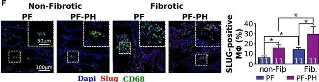 Mouse IgG (H+L) Cross-Adsorbed Secondary Antibody in Immunohistochemistry (Paraffin) (IHC (P))