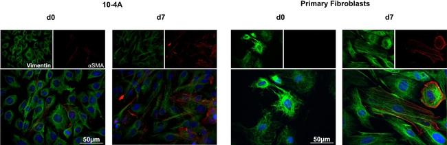 Rabbit IgG (H+L) Cross-Adsorbed Secondary Antibody in Immunocytochemistry (ICC/IF)